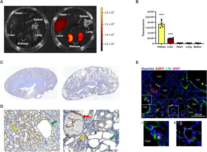 Rapamycin-encapsulated nanoparticle delivery in polycystic kidney disease mice