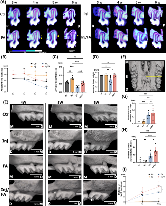 Prevention of bone dehiscence associated with orthodontic tooth ...