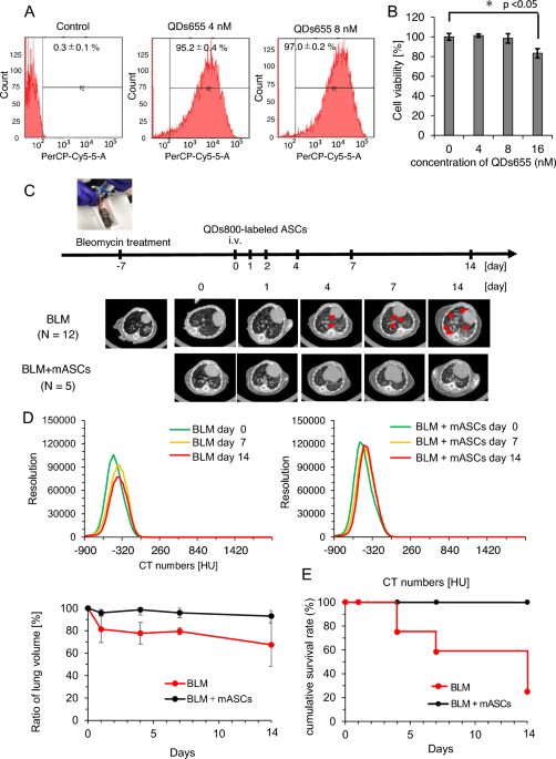 Establishment of a stem cell administration imaging method in bleomycin