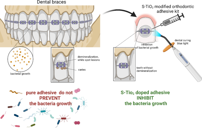 Physical, mechanical and antibacterial properties of the orthodontic ...