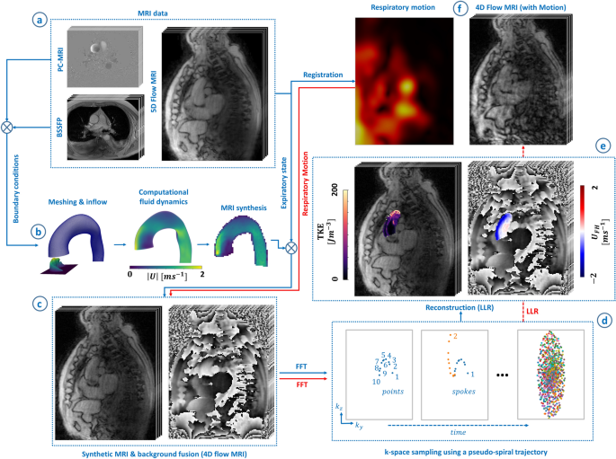 Optimizing encoding strategies for 4D Flow MRI of mean and