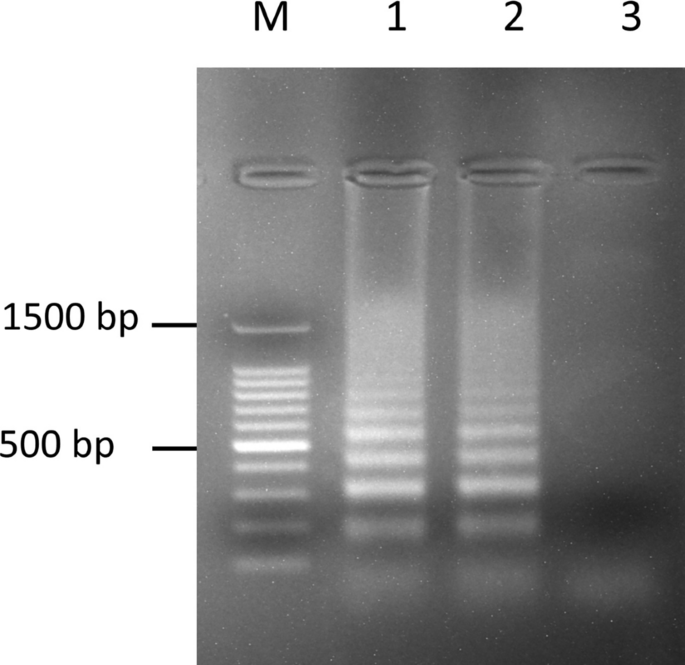 Optimization of loop-mediated isothermal amplification assay for sunflower mildew disease detection