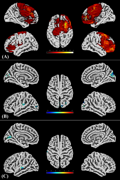 Short-term changes in brain networks and cognition in children with ...