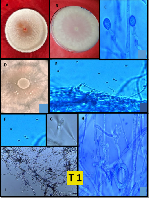 Molecular characterization of plant growth-promoting Trichoderma from ...