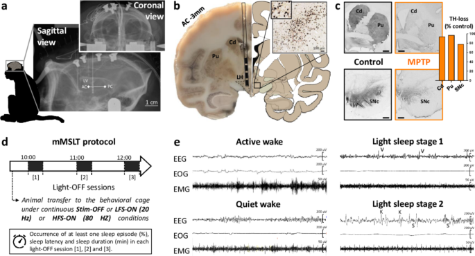 Effects of High-Frequency Stimulation on Sleep-Wake Behavior in a Parkinsonian Monkey Model