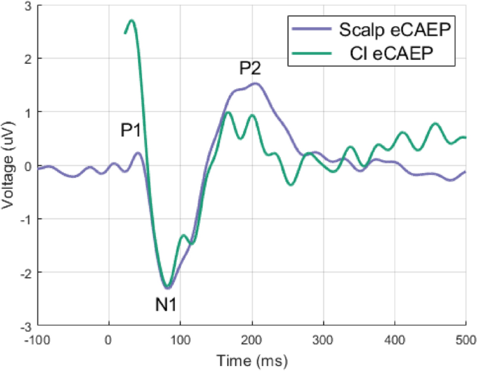 Validation of direct recording of electrically evoked cortical auditory ...