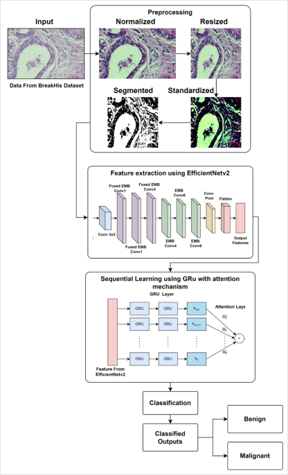 Hybrid EfficientNet-GRU Model for Enhanced Breast Cancer Detection in Histopathology Images