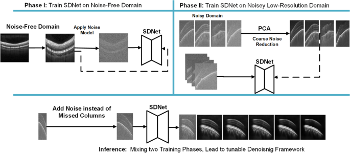 Enhancing Low-SNR SS-OCT Imaging with Self-Supervised Deep Learning