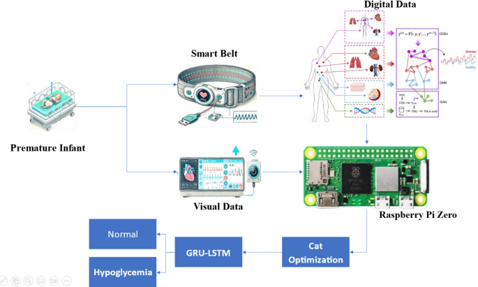 Deep Learning Network with Dual Smart Sensors for Detecting Hypoglycemia in Premature Infants