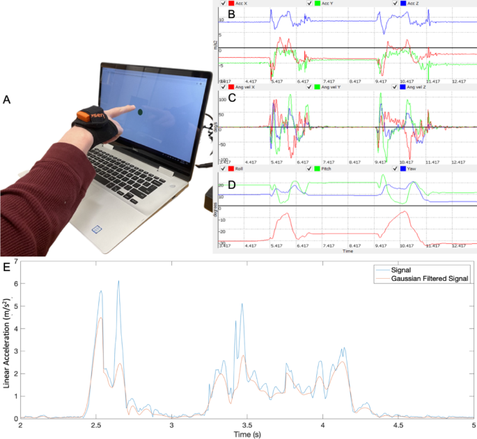 Enhanced Diagnosis of Neurodivergent Disorders Through Deep Learning and Kinematic Severity Assessment
