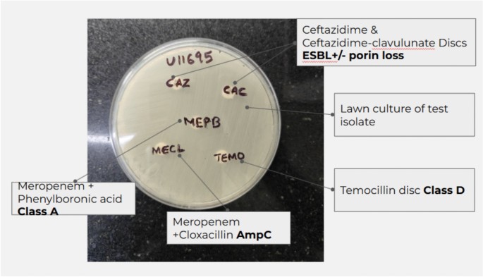 Phenotypic characterisation and prevalence of carbapenem-resistant Enterobacterales in a tertiary care centre in Bihar India