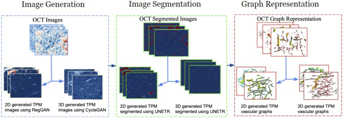 Improving microvascular brain analysis with adversarial learning for OCT-TPM vascular domain translation