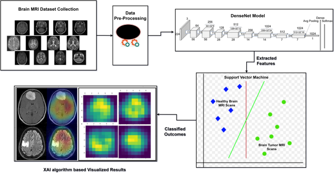 Synergizing advanced algorithm of explainable artificial intelligence with hybrid model for enhanced brain tumor detection in healthcare
