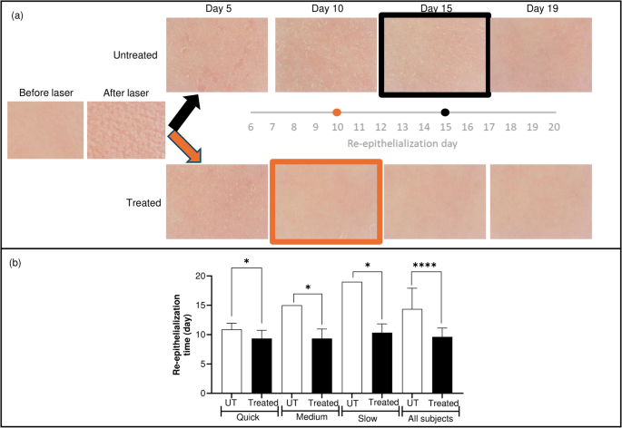 lipo c reconstitution B12 vs Lipotropic Shots: Energy Boost vs Fat Metabolism Support