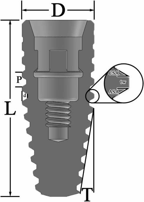 Thread design optimization of a dental implant using explicit dynamics finite element analysis Thread design optimization of a dental implant using explicit dynamics finite element analysis