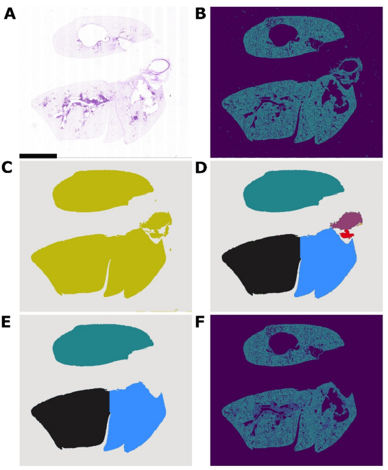 Using Computer Vision to Predict Cell Coverage in Re-Endothelialized Mouse Lungs