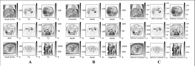 Deep Learning-Driven Automation of Abdominal MRI Analysis