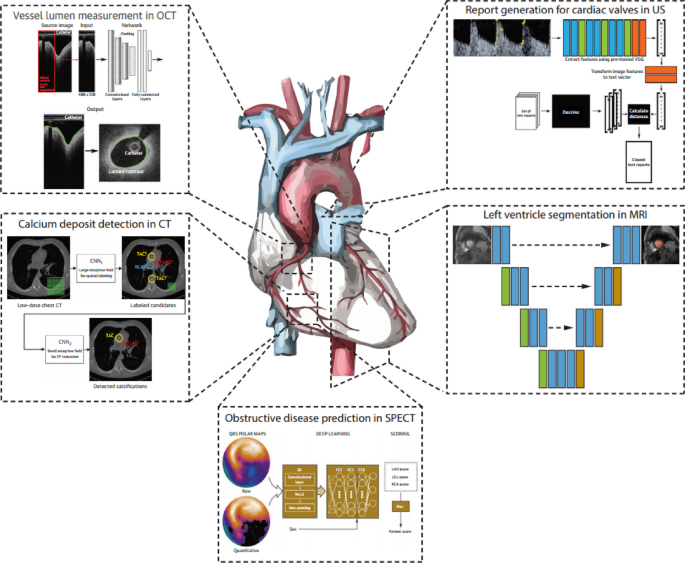 Revolutionizing Cardiac Disease Detection with Machine Learning and Medical Imaging