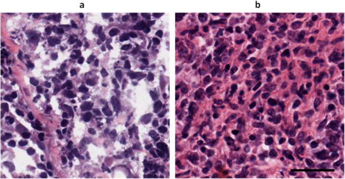 Improving Frozen Histology Images with Deep Learning and Nuclei Attention