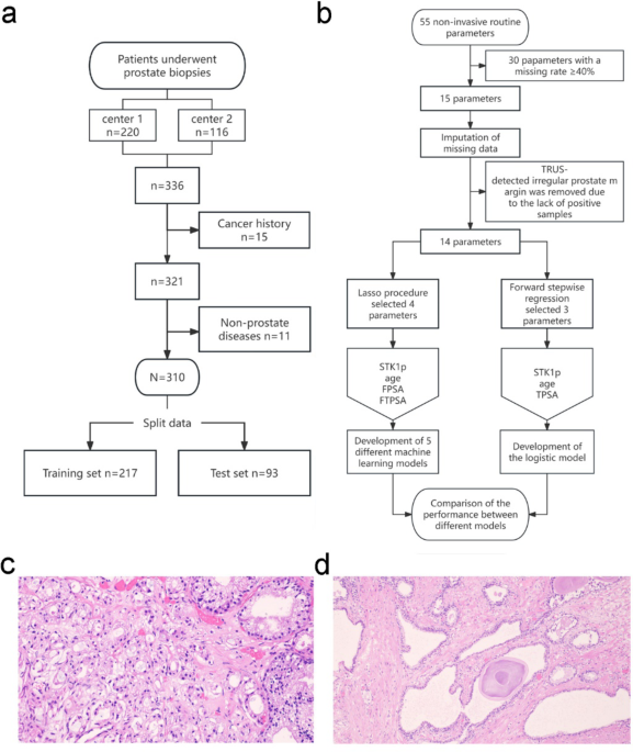 Visual Machine Learning Model for Distinguishing Prostate Cancer Risk in Men Before Biopsy