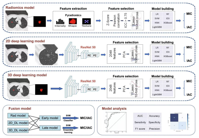 Integrating Deep Learning and Radiomics to Predict Invasiveness of Lung Adenocarcinoma in Ground Glass Nodules