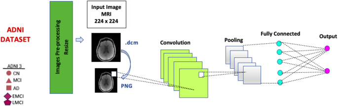Enhancing Early Alzheimer’s Detection with MRI Slice Selection and Deep Learning