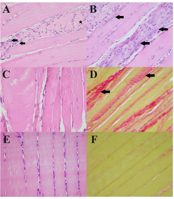 glutathione muscular dystrophy Transcriptomic profiling of skeletal muscle in the DMDmdx rat model of Duchenne Repurposing disulfiram, an alcohol-abuse Dark Knees Treatment Flavor:Vanilla Wafer
