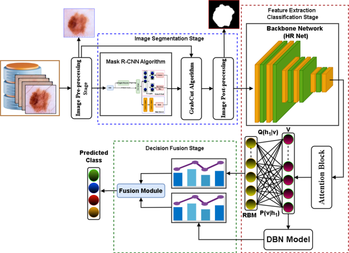 Automated Early Diagnosis and Classification of Skin Cancer Lesions Using Deep Learning in Dermoscopy Images
