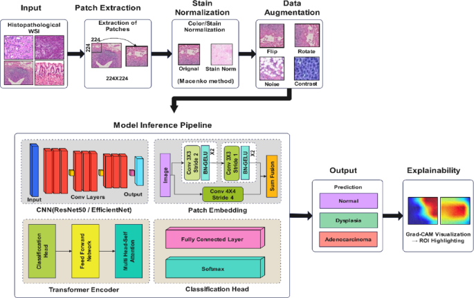 An interpretable hybrid deep learning framework for gastric cancer diagnosis using histopathological imaging