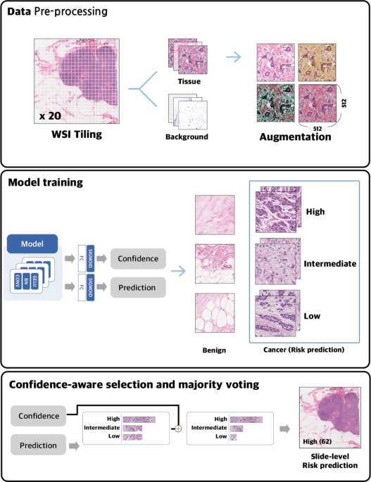 Assessing the risk of recurrence in early-stage breast cancer through H ...