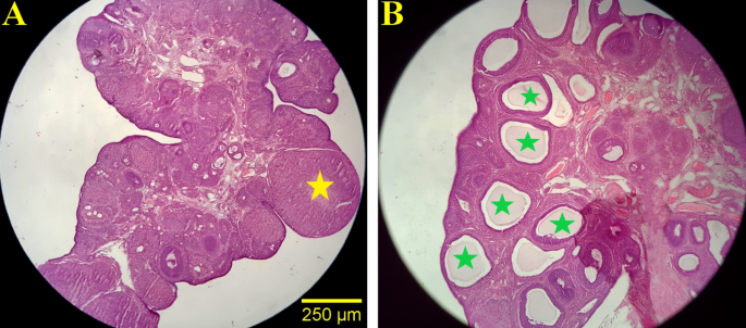 Quercetin modulates the interplay between DNMT gene expression, oxidative  stress, and trace elements in DHEA-induced polycystic ovary syndrome rat  model