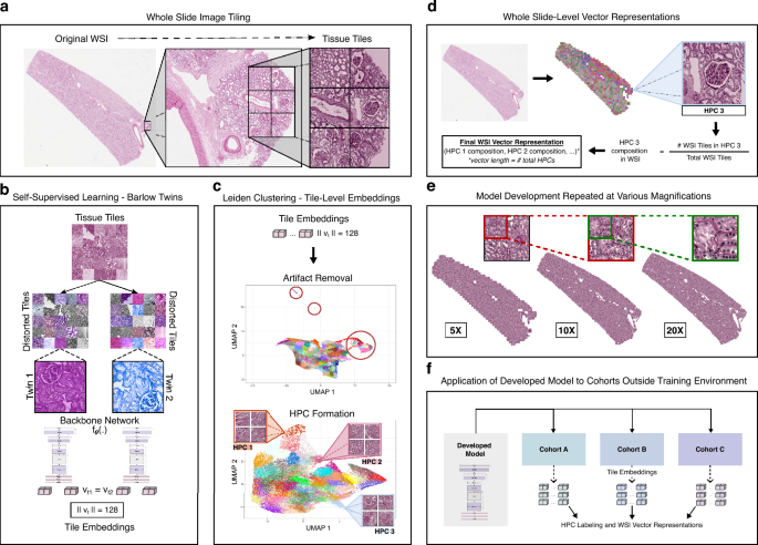Unbiased self supervised learning of kidney histology reveals ...