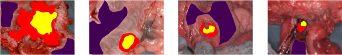 Enhancing Deep Learning for Colorectal Cancer Detection: The Impact of Preprocessing Techniques in Hyperspectral Imaging