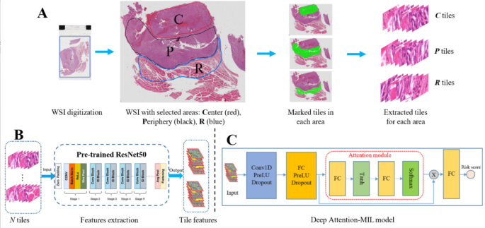 Prognostic prediction in soft-tissue sarcomas using deep learning and ...