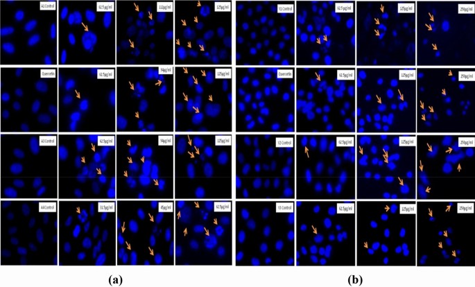 Author Correction: Preparation, characterization and antioxidant and anticancerous potential of Quercetin loaded β-glucan particles derived from mushroom and yeast