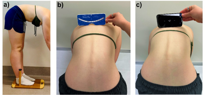 Digital twin for the analog scoliometer: advancements in telehealth for ...