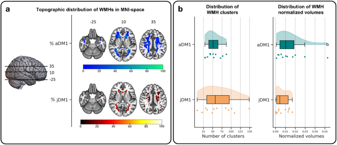 Characterizing white matter hyperintensities in myotonic dystrophy type ...