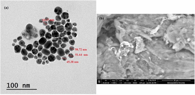 glutathione chelation aluminum Ferulic acid-loaded chitosan nanoparticles enhance radiotherapy efficacy via STAT3 suppression and caspase-8/p53 activation in Ehrlich ascites carcinoma Type:Vitamin D3 + K2 Get Your Glow On: mod. des.