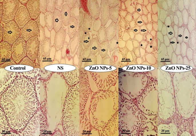 Efficacy of zinc oxide nanoparticles in chemical castration of male Wistar  rats | Scientific Reports