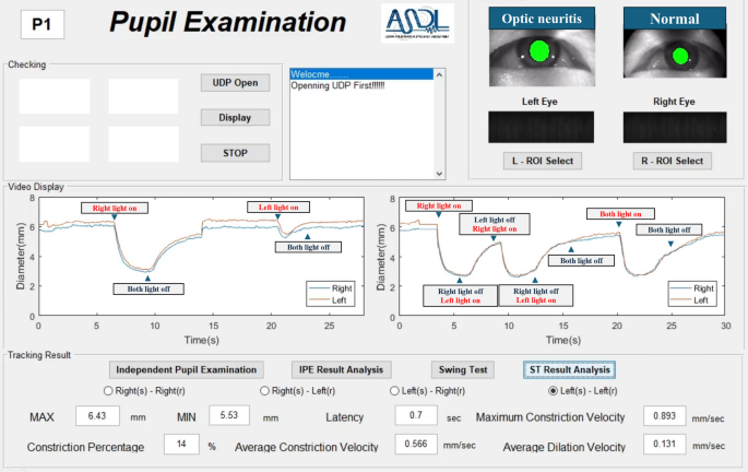 Development and pilot evaluation of a binocular virtual reality Headset ...