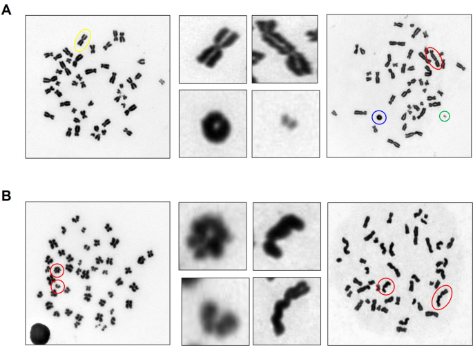 Optimized dicentric chromosome dose–response curves with centromere ...
