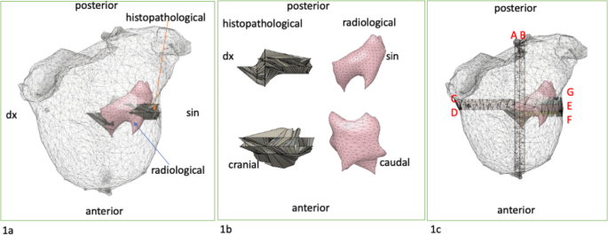 A pilot study comparing three-dimensional models of tumor ...
