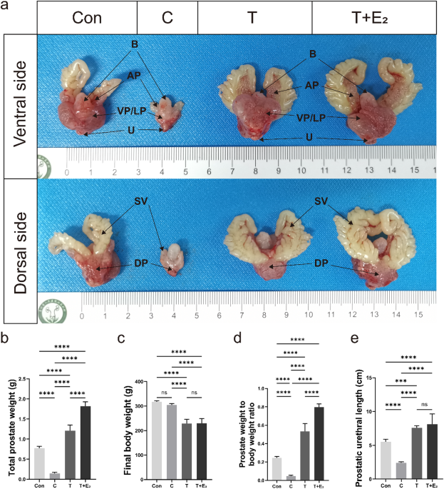 Comprehensive RNA-seq analysis of benign prostatic hyperplasia (BPH) in ...
