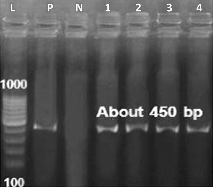 Molecular characterization of some multidrug resistant Candida Auris in ...