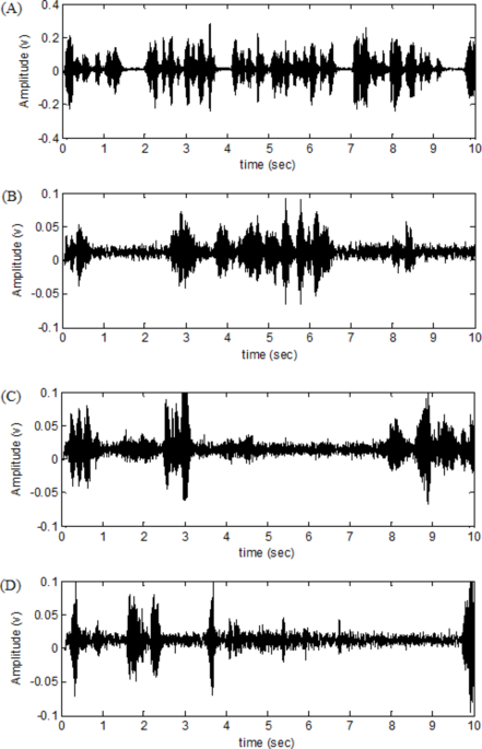 Small-world networks propensity in spontaneous speech signals of Alzheimer’s disease: visibility graph analysis