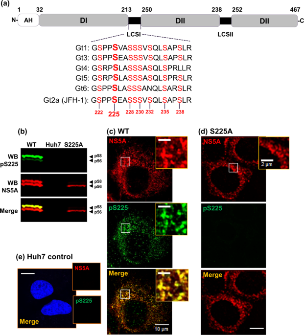 glass lipase hep c Central role of hepatic (HL) in lipid metabolism. The oval Hepatocellular Ballooning is Due to