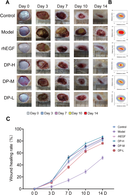 glutathione in wound healing ncbi Reactive Oxygen Species and Antioxidants Healing: Mechanisms and Therapeutic Potential The role of glucose metabolism