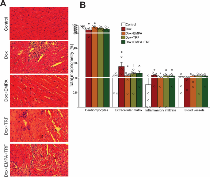 Empagliflozin and intermittent fasting as a strategy to mitigate  anthracycline-induced cardiotoxicity