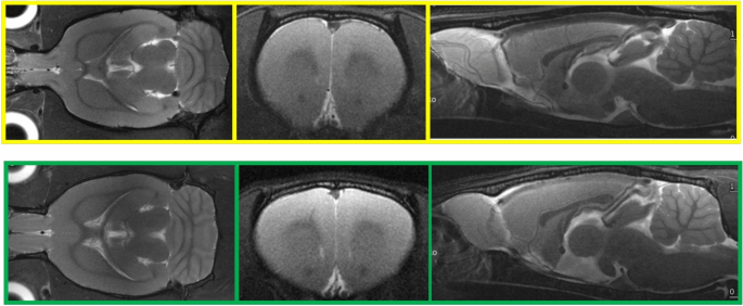 alpha-gpc stability with creatine nac taurine acetyl-l-carnitine Neuroimaging insights from Wistar-Kyoto rats under chronic mild stress:  morphological and metabolic brain correlates of treatment-resistant  depression