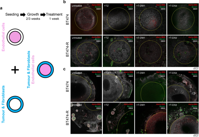 igf-1 lr3 dosage protocol 50mcg 2x a day in Aesthetic and Anti-Aging Medicine: Benefits and Risks Deruxtecan-based antibodydrug-conjugates induce senescence in
